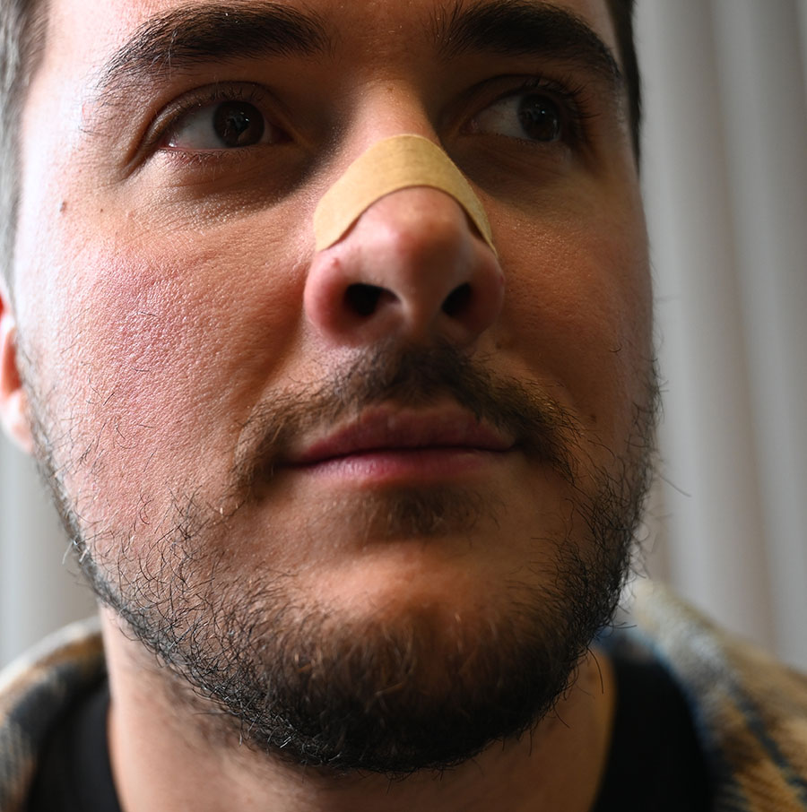 Použití Lunesto Nasal Strips